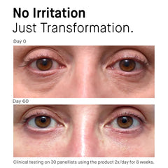 1% Bakuchiol + Peptides: Age Delay Serum