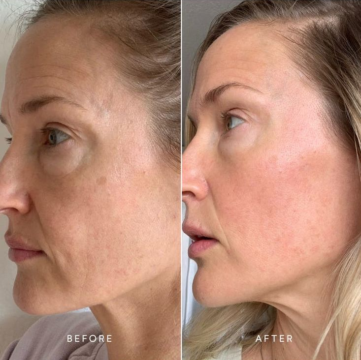 Bakuchiol Age Delay Serum before and after results showing smoother fine lines